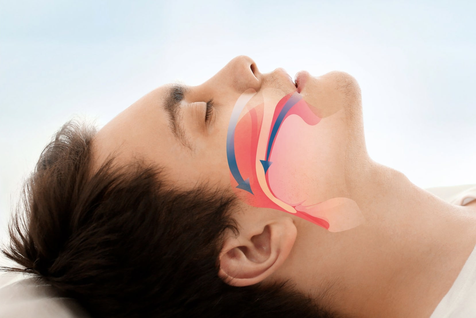 COSA SONO LE APNEE NOTTURNE? LA SOLUZIONE DELL’ODONTOIATRA