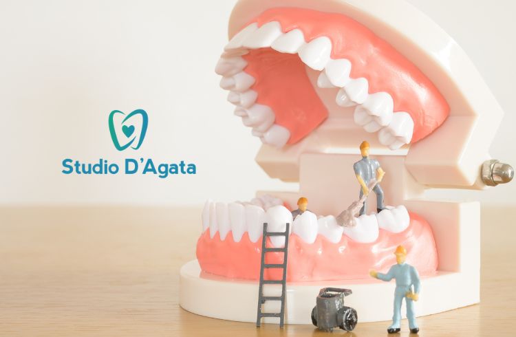 Mantenimento e cura degli impianti dentali
