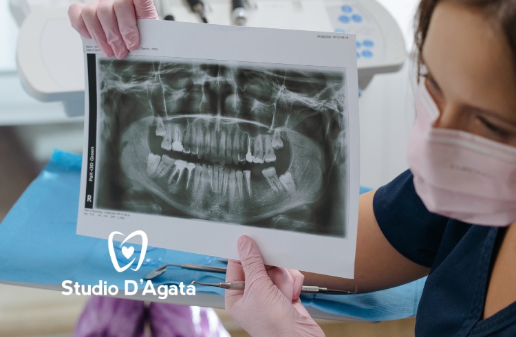 la bocca dopo la perdita di un dente