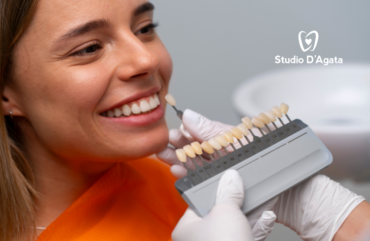 Faccette dentali: cosa sono davvero, per chi servono e quanto durano